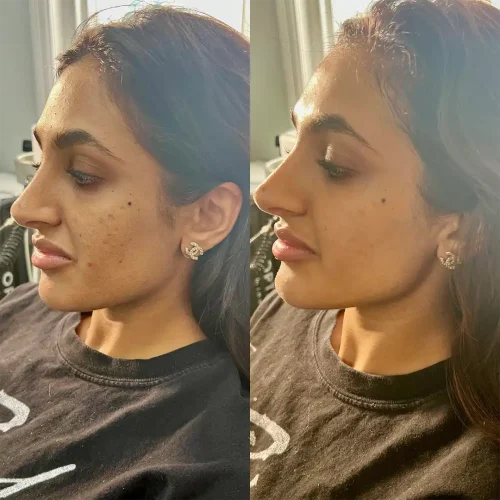 Before and After PureHydro 3